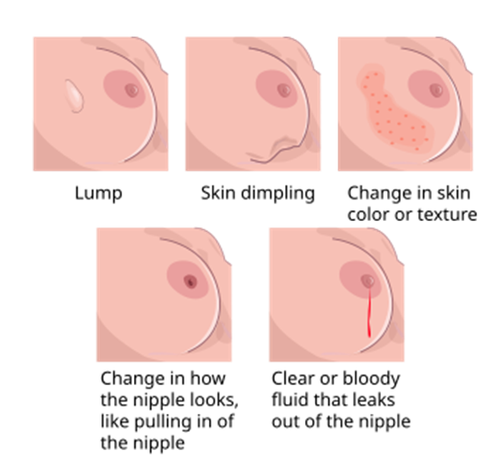 ny10_586808.png image.png