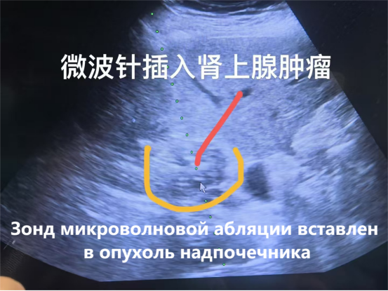 fuda20_518255.png fuda20_518255.png