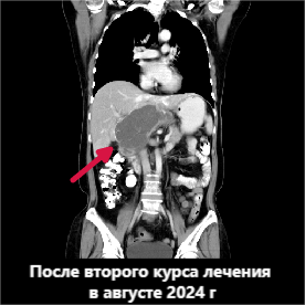 fuda14_488261.png image.png