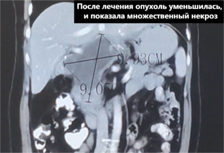 fuda14_820657.png image.png